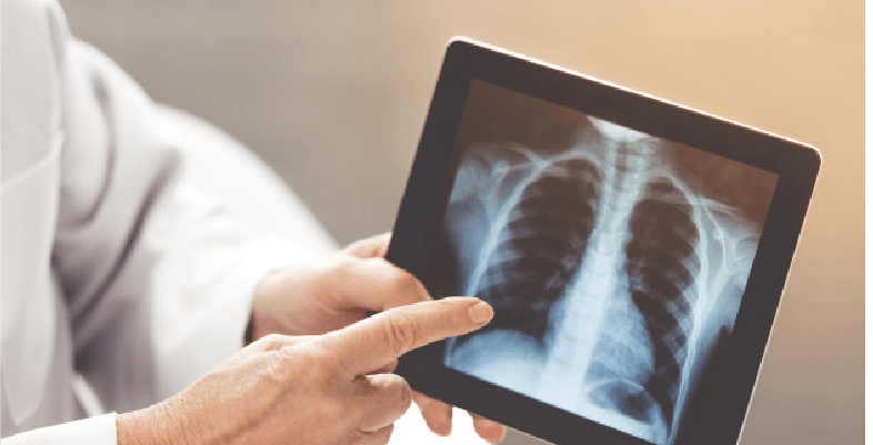 Diploma in X-Ray Technology